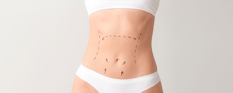 Abdominoplasty Specialist Near Me in Princeton, NJ and North Brunswick, NJ

