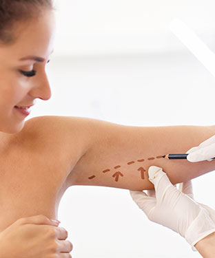 Arm Lift - Partridge Plastic Surgery in North Brunswick, NJ and Princeton, NJ