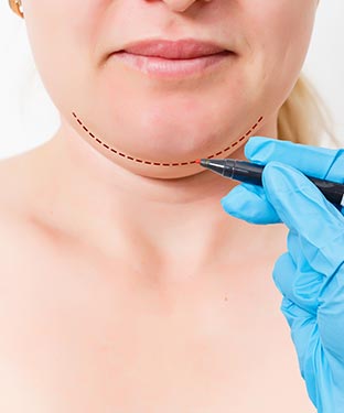 Chin Augmentation Specialist Near Me in Princeton, NJ and North Brunswick, NJ
