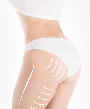 Buttock Lift - Partridge Plastic Surgery in North Brunswick, NJ and Princeton, NJ