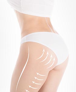 Buttock Lift Specialist Near Me in Princeton, NJ and North Brunswick, NJ
