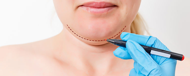 Chin Augmentation Specialist Near Me in Princeton, NJ and North Brunswick, NJ