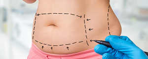 Cost of Tummy Tuck Procedure Near Me in Princeton, NJ