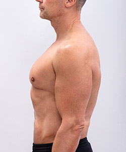 Abdominal Etching - Partridge Plastic Surgery in North Brunswick, NJ and Princeton, NJ