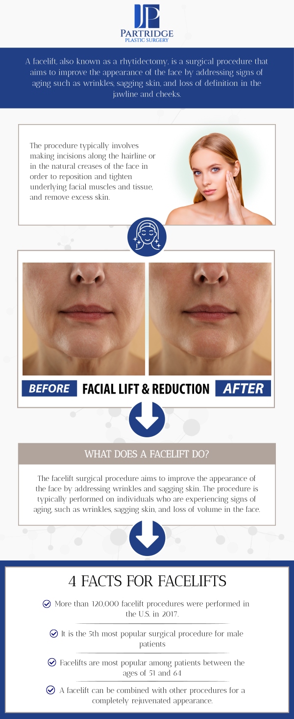 Facelift surgery is a highly effective procedure to reduce signs of aging, such as sagging skin and deep wrinkles, giving you a more youthful and refreshed appearance. At Partridge Plastic Surgery, Dr. Joanna Partridge, MD, a board-certified female plastic surgeon, and her team provide personalized care to ensure the best possible outcome, helping you achieve natural-looking, long-lasting results. Whether you’re looking to address the face, neck, or jawline, facelift surgery can help restore your confidence and enhance your overall appearance. For more information, contact us today or schedule an appointment online. We have convenient locations to serve you in Princeton, NJ, and North Brunswick, NJ. Facelift surgery is a highly effective procedure to reduce signs of aging, such as sagging skin and deep wrinkles, giving you a more youthful and refreshed appearance. At Partridge Plastic Surgery, Dr. Joanna Partridge, MD, a board-certified female plastic surgeon, and her team provide personalized care to ensure the best possible outcome, helping you achieve natural-looking, long-lasting results. Whether you’re looking to address the face, neck, or jawline, facelift surgery can help restore your confidence and enhance your overall appearance. For more information, contact us today or schedule an appointment online. We have convenient locations to serve you in Princeton, NJ, and North Brunswick, NJ.