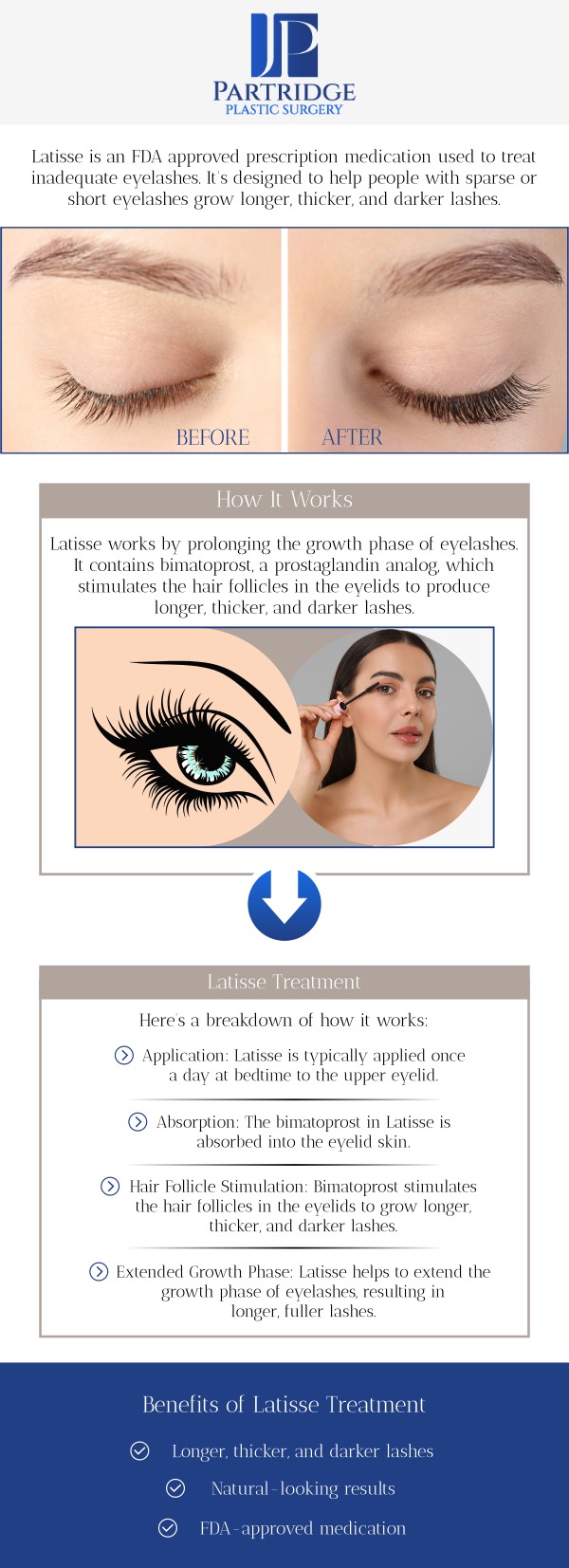 Latisse is a prescription treatment that helps to enhance the length, thickness, and fullness of your eyelashes. This FDA-approved solution is applied directly to the lash line, encouraging natural growth for fuller, more defined lashes. The treatment works gradually, with noticeable improvements in as little as eight weeks. At Partridge Plastic Surgery, Dr. Joanna Partridge, MD, a board-certified plastic surgeon, provides personalized care to ensure optimal results. We offer guidance throughout the process to help you achieve the lush, voluminous lashes you’ve always desired. For more information, contact us today or schedule an appointment online. We have convenient locations in Princeton, NJ, and North Brunswick, NJ. Latisse is a prescription treatment that helps to enhance the length, thickness, and fullness of your eyelashes. This FDA-approved solution is applied directly to the lash line, encouraging natural growth for fuller, more defined lashes. The treatment works gradually, with noticeable improvements in as little as eight weeks. At Partridge Plastic Surgery, Dr. Joanna Partridge, MD, a board-certified plastic surgeon, provides personalized care to ensure optimal results. We offer guidance throughout the process to help you achieve the lush, voluminous lashes you’ve always desired. For more information, contact us today or schedule an appointment online. We have convenient locations in Princeton, NJ, and North Brunswick, NJ.