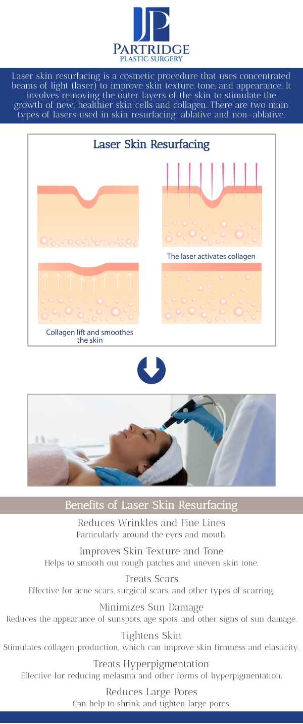 Laser skin resurfacing is a non-invasive treatment designed to improve the appearance of the skin by reducing wrinkles, scars, and blemishes. At Partridge Plastic Surgery, Dr. Joanna Partridge, MD, a board-certified female plastic surgeon, offers advanced laser resurfacing techniques to reveal smoother, more youthful skin. Our team provides personalized consultations to tailor the treatment to your specific needs, ensuring optimal results and a rejuvenated, refreshed appearance. For more information, contact us today or schedule an appointment online. We have convenient locations in Princeton, NJ, and North Brunswick, NJ. Laser skin resurfacing is a non-invasive treatment designed to improve the appearance of the skin by reducing wrinkles, scars, and blemishes. At Partridge Plastic Surgery, Dr. Joanna Partridge, MD, a board-certified female plastic surgeon, offers advanced laser resurfacing techniques to reveal smoother, more youthful skin. Our team provides personalized consultations to tailor the treatment to your specific needs, ensuring optimal results and a rejuvenated, refreshed appearance. For more information, contact us today or schedule an appointment online. We have convenient locations in Princeton, NJ, and North Brunswick, NJ.