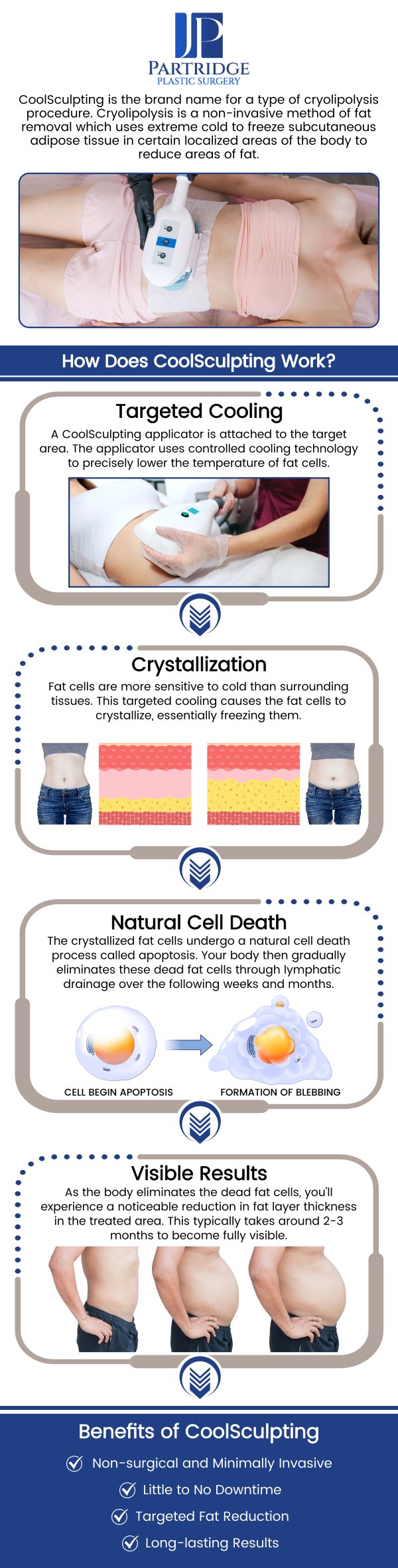 CoolSculpting is a non-invasive treatment designed to target and eliminate stubborn fat areas without surgery. Using advanced cooling technology, it freezes fat cells, which are naturally processed and eliminated by your body over time. CoolSculpting has no downtime, allowing you to return to your daily activities immediately after the procedure, and provides gradual, natural-looking results that develop over time, giving you a more sculpted physique without the need for invasive surgery. At Partridge Plastic Surgery, board-certified female plastic surgeon Dr. Joanna Partridge, MD, offers this treatment, helping patients achieve lasting body contouring results when combined with a healthy lifestyle. For more information, contact us today or schedule an appointment online. We have convenient locations in Princeton, NJ, and North Brunswick, NJ.