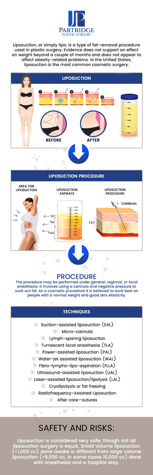 Liposuction is an effective solution for removing stubborn fat and achieving a more sculpted body shape. At Partridge Plastic Surgery, Dr. Joanna Partridge, MD, a board-certified female plastic surgeon, specializes in liposuction procedures. Whether you're looking to contour specific areas or improve overall body proportions, our personalized approach ensures natural looking and long lasting results that enhance your confidence and appearance. For more information, contact us today or schedule an appointment online. We have convenient locations to serve you in Princeton, NJ, and North Brunswick, NJ. Liposuction is an effective solution for removing stubborn fat and achieving a more sculpted body shape. At Partridge Plastic Surgery, Dr. Joanna Partridge, MD, a board-certified female plastic surgeon, specializes in liposuction procedures. Whether you're looking to contour specific areas or improve overall body proportions, our personalized approach ensures natural looking and long lasting results that enhance your confidence and appearance. For more information, contact us today or schedule an appointment online. We have convenient locations to serve you in Princeton, NJ, and North Brunswick, NJ.