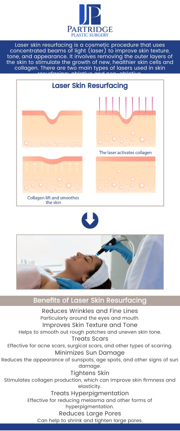 Laser skin resurfacing is a non-invasive treatment designed to improve the appearance of the skin by reducing wrinkles, scars, and blemishes. At Partridge Plastic Surgery, Dr. Joanna Partridge, MD, a board-certified female plastic surgeon, offers advanced laser resurfacing techniques to reveal smoother, more youthful skin. Our team provides personalized consultations to tailor the treatment to your specific needs, ensuring optimal results and a rejuvenated, refreshed appearance. For more information, contact us today or schedule an appointment online. We have convenient locations in Princeton, NJ, and North Brunswick, NJ. Laser skin resurfacing is a non-invasive treatment designed to improve the appearance of the skin by reducing wrinkles, scars, and blemishes. At Partridge Plastic Surgery, Dr. Joanna Partridge, MD, a board-certified female plastic surgeon, offers advanced laser resurfacing techniques to reveal smoother, more youthful skin. Our team provides personalized consultations to tailor the treatment to your specific needs, ensuring optimal results and a rejuvenated, refreshed appearance. For more information, contact us today or schedule an appointment online. We have convenient locations in Princeton, NJ, and North Brunswick, NJ.