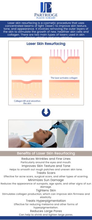 Laser skin resurfacing is a non-invasive treatment designed to improve the appearance of the skin by reducing wrinkles, scars, and blemishes. At Partridge Plastic Surgery, Dr. Joanna Partridge, MD, a board-certified female plastic surgeon, offers advanced laser resurfacing techniques to reveal smoother, more youthful skin. Our team provides personalized consultations to tailor the treatment to your specific needs, ensuring optimal results and a rejuvenated, refreshed appearance. For more information, contact us today or schedule an appointment online. We have convenient locations in Princeton, NJ, and North Brunswick, NJ. Laser skin resurfacing is a non-invasive treatment designed to improve the appearance of the skin by reducing wrinkles, scars, and blemishes. At Partridge Plastic Surgery, Dr. Joanna Partridge, MD, a board-certified female plastic surgeon, offers advanced laser resurfacing techniques to reveal smoother, more youthful skin. Our team provides personalized consultations to tailor the treatment to your specific needs, ensuring optimal results and a rejuvenated, refreshed appearance. For more information, contact us today or schedule an appointment online. We have convenient locations in Princeton, NJ, and North Brunswick, NJ.